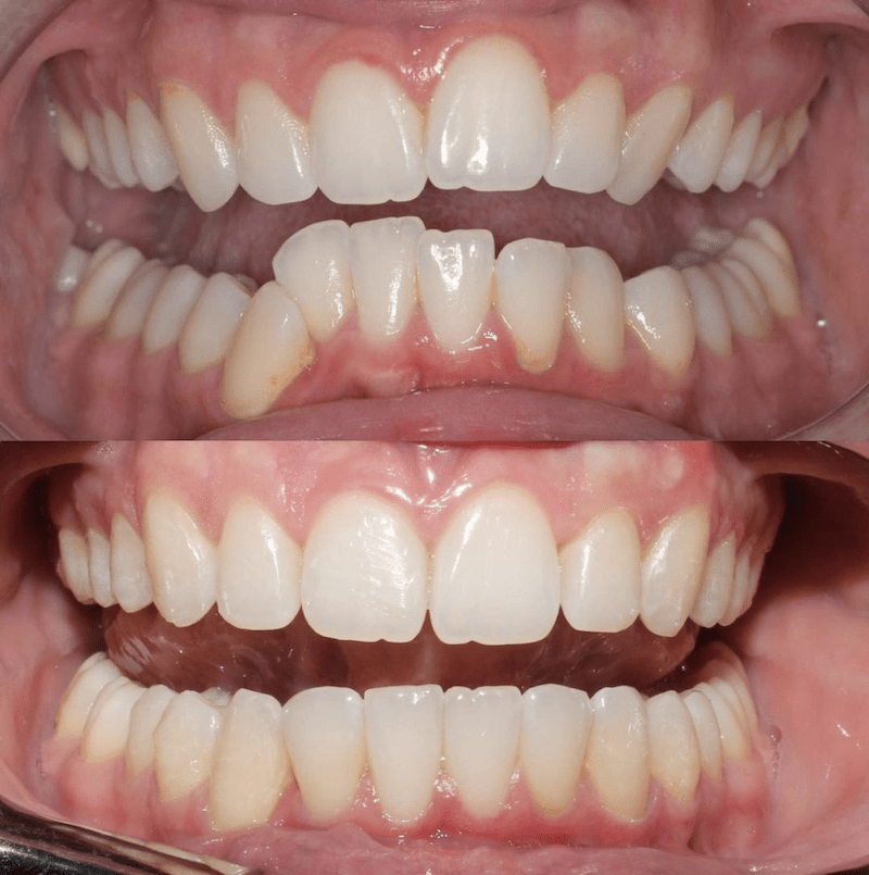 El Boom de la Ortodoncia en plena pandemia