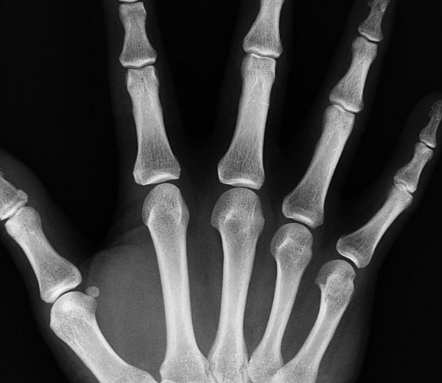 centro radiológico carabanchel