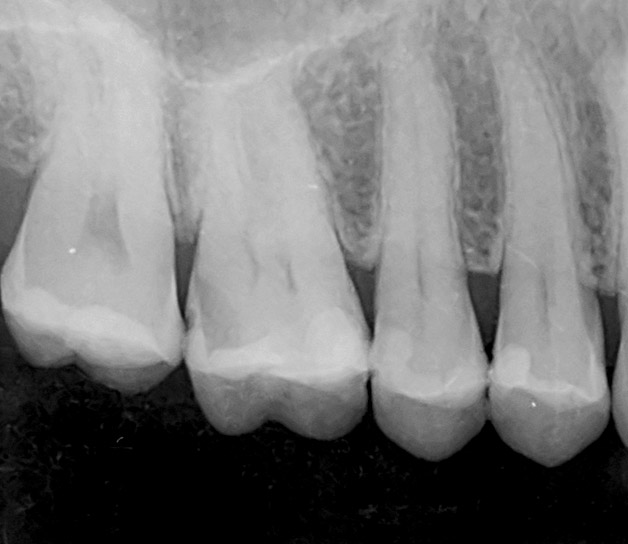 centro radiológico carabanchel