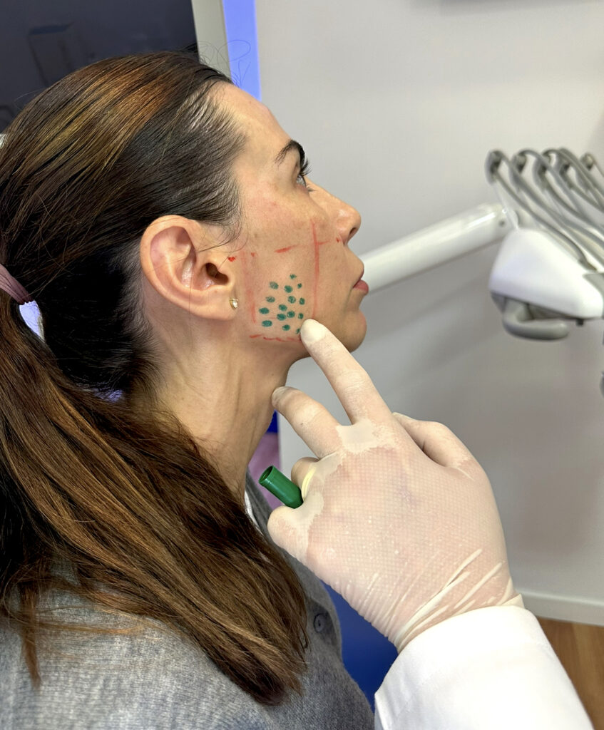 tratamiento del bruxismo 1